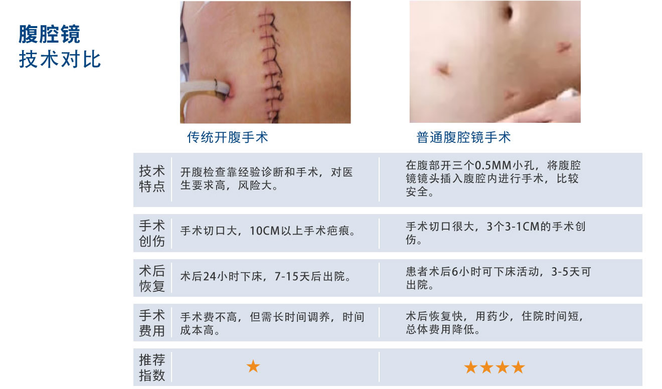 腹腔镜技术对比